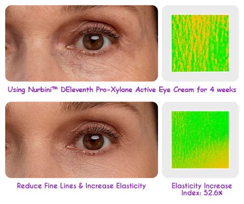 🎁Last Day 49% OFF👀DEleventh Pro-Xylane Active Eye Cream🤩😍💃🏼