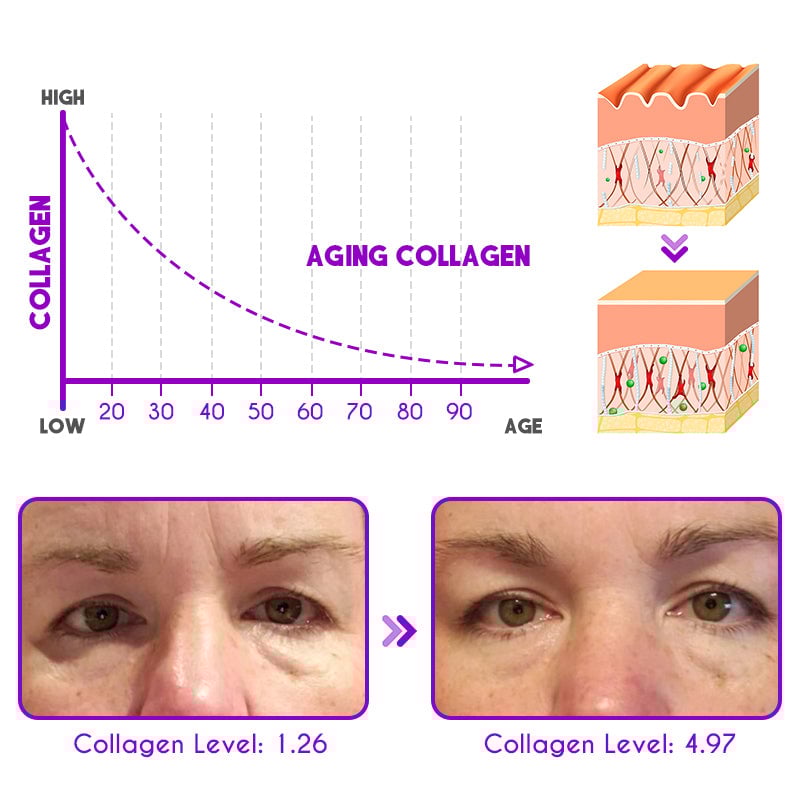 🎁Last Day 49% OFF👀DEleventh Pro-Xylane Active Eye Cream🤩😍💃🏼