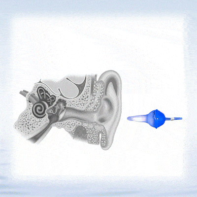 🎉BUY 2 PAIRS GET 20% OFF💥2025 NEW DESIGN-👂The World's First Fluid Inflatable Earplug