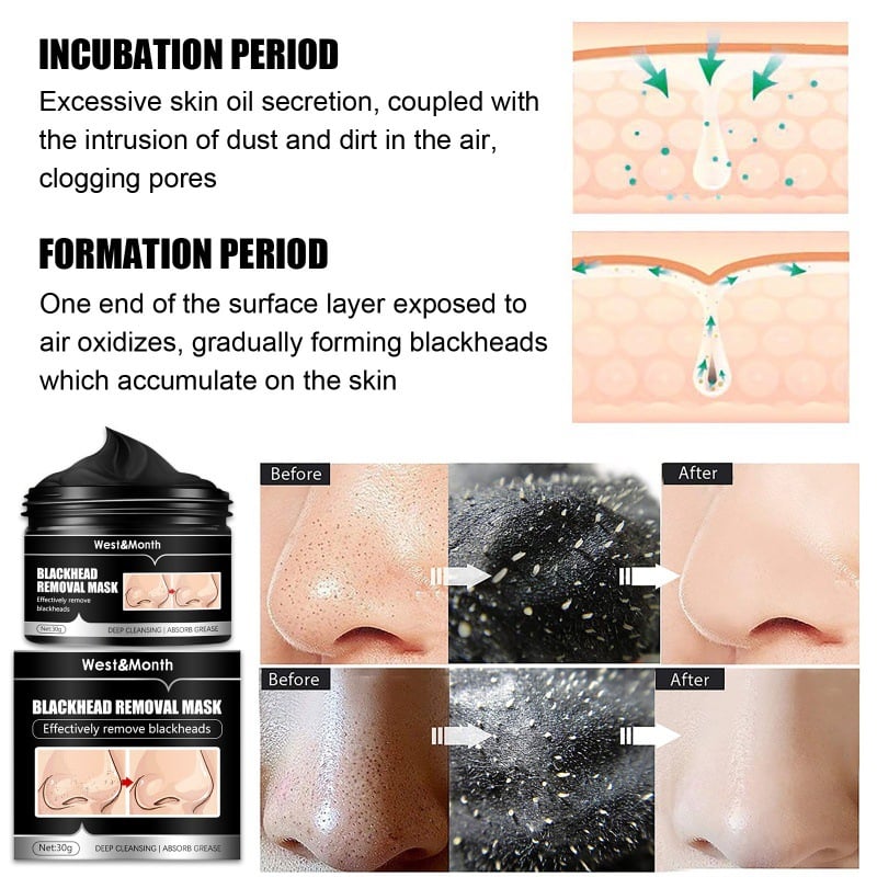 🔥Last Day 49% OFF🔥Bamboo Charcoal Peel Off Mask